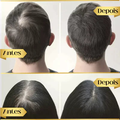 Tônico Capilar Repair Hair